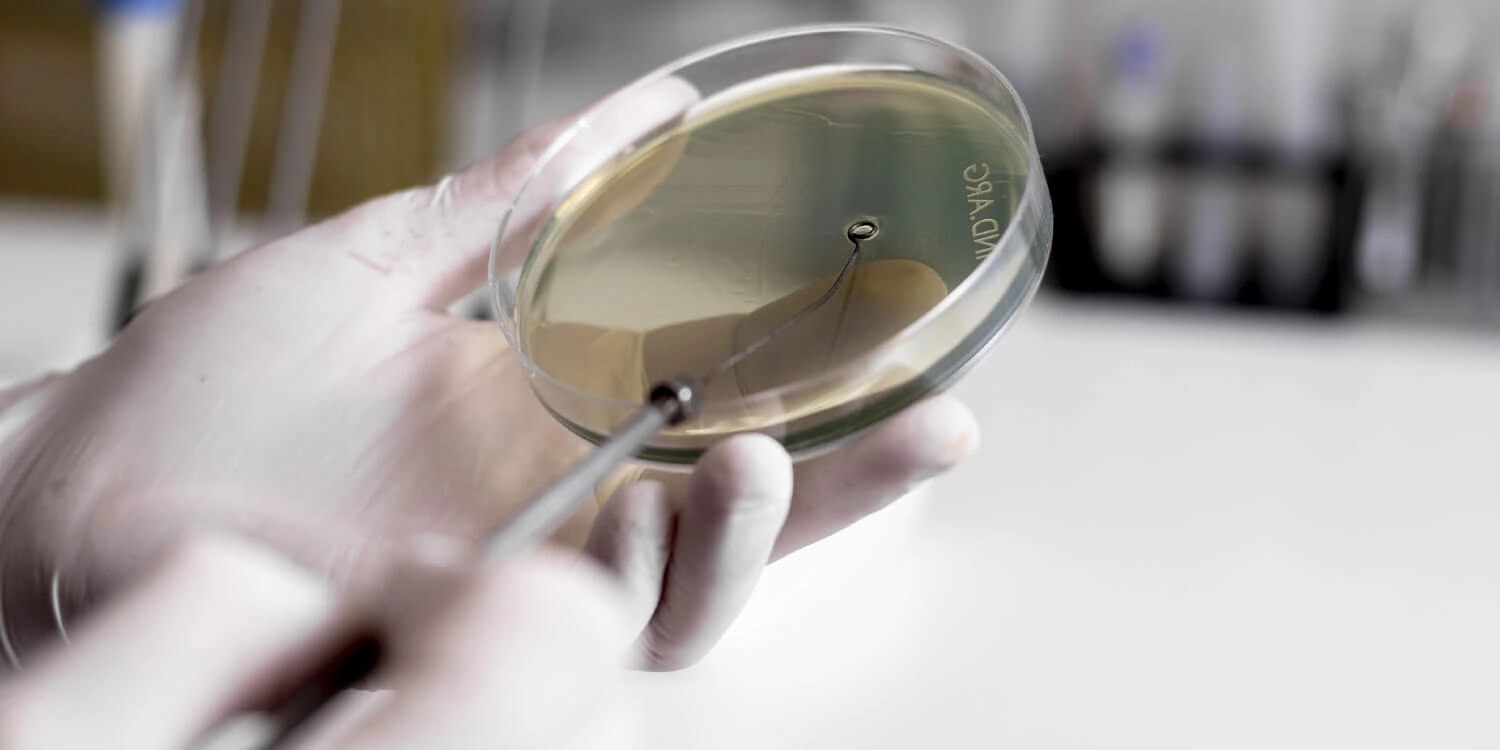 Laboratorio Perez Elizalde - Servicios - Autoinmunidad (1)