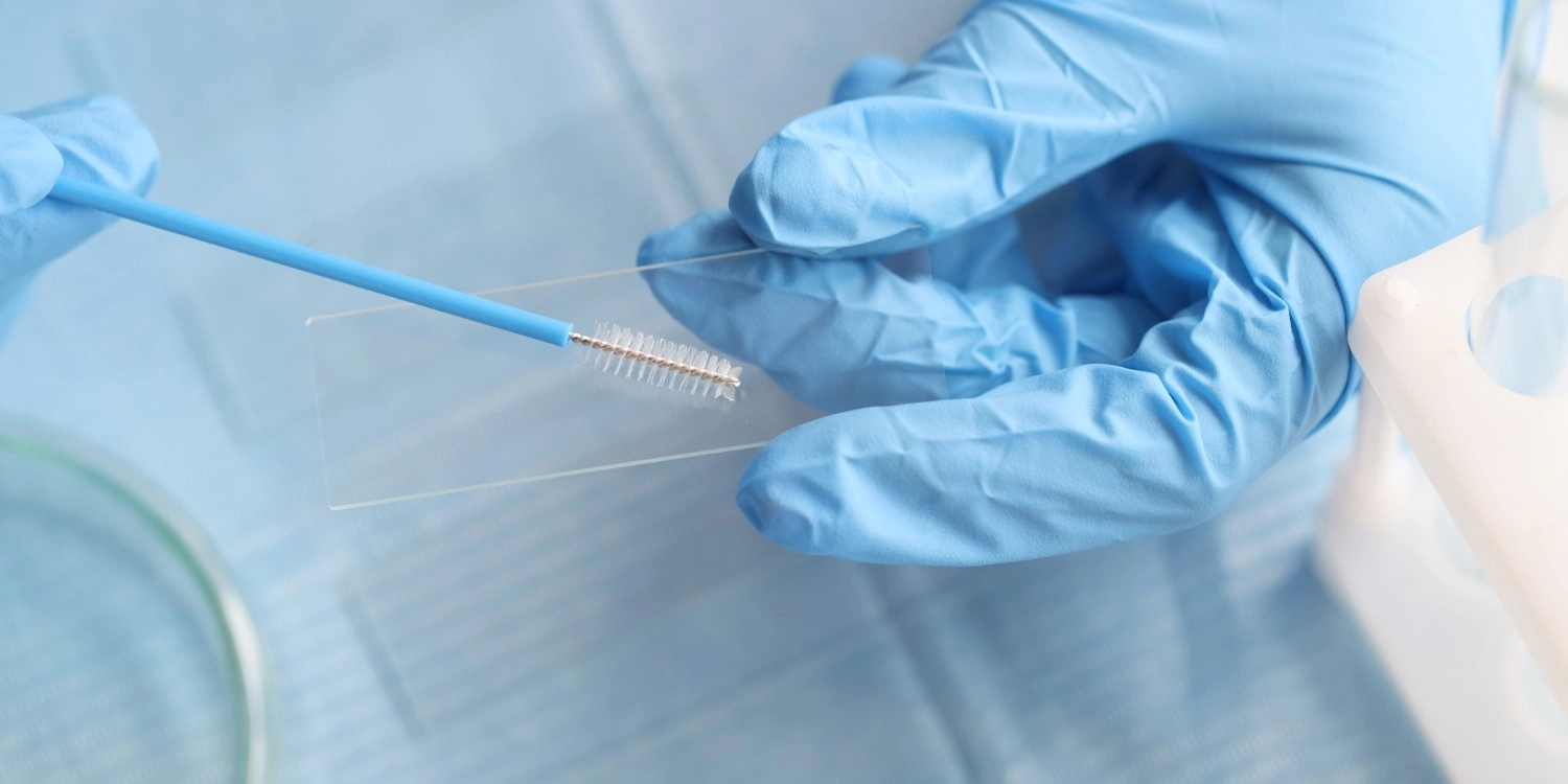 Laboratorio Perez Elizalde - Servicios - Autoinmunidad (3)