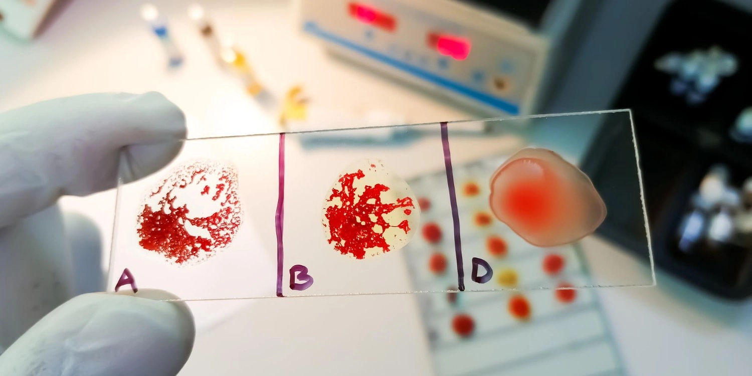 Laboratorio Perez Elizalde - Servicios - Endocrinologia (3)