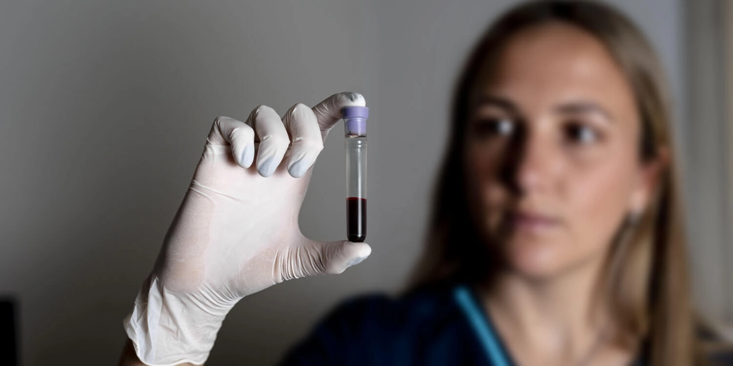 Laboratorio Perez Elizalde - Servicios - Hematologia (1)