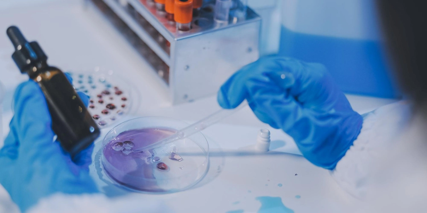 Laboratorio Perez Elizalde - Servicios - Inmunologia (1)