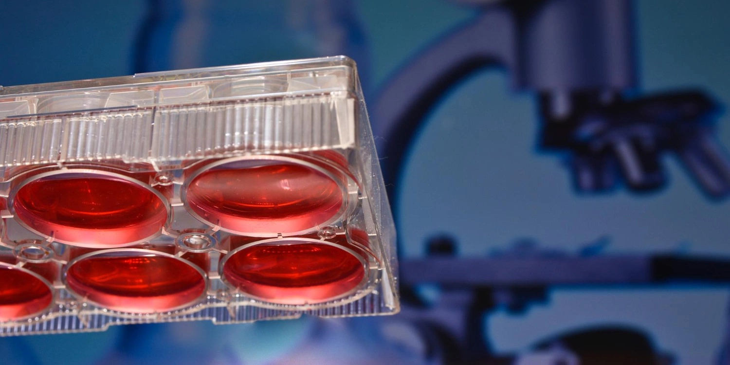 Laboratorio Perez Elizalde - Servicios - Inmunologia (2)