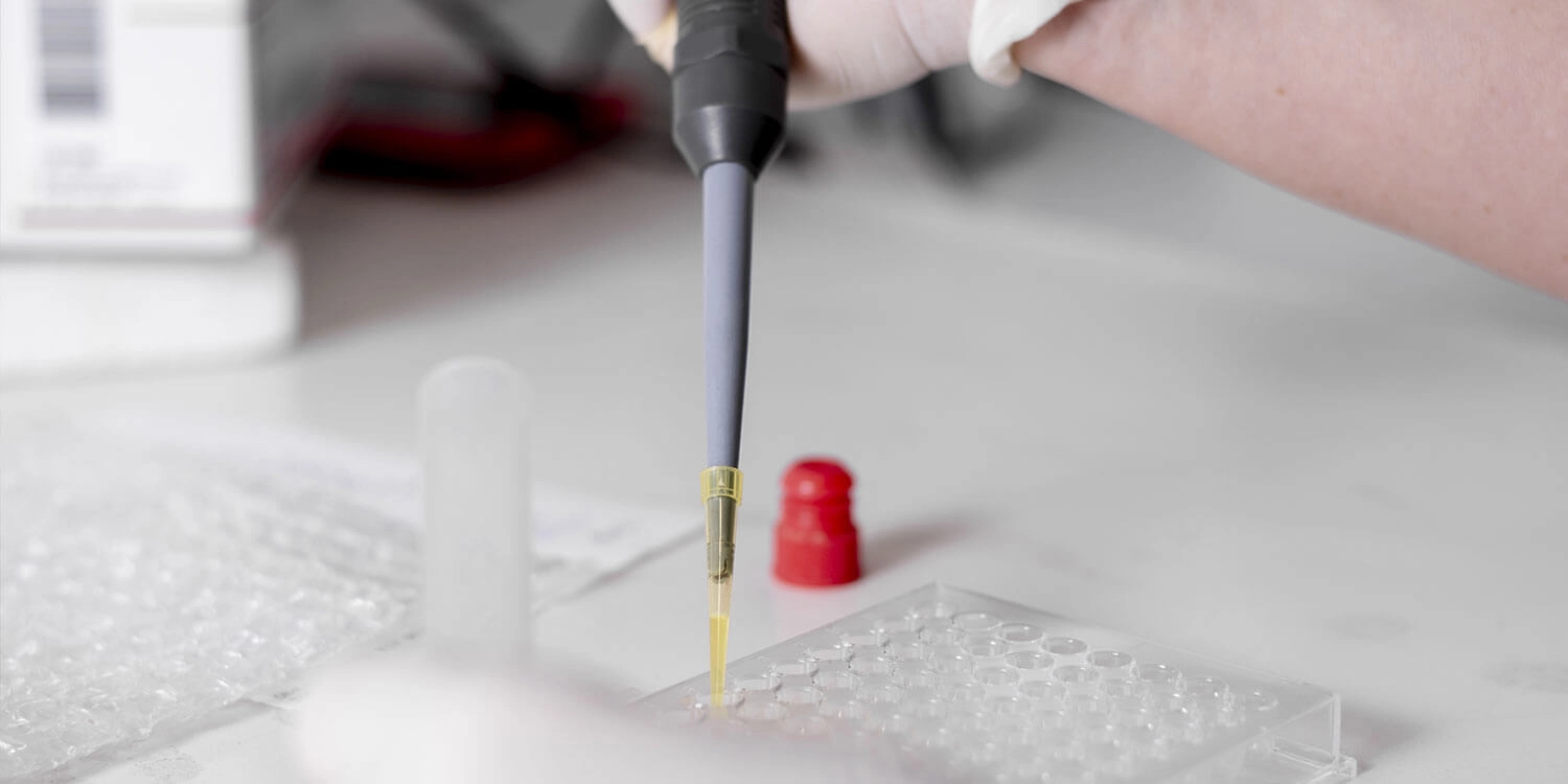 Laboratorio Perez Elizalde - Servicios - Monitoreo de Drogas de Abuso y Terapeuticas (1)