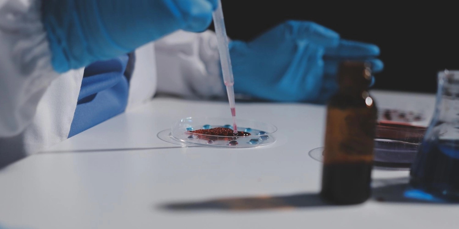 Laboratorio Perez Elizalde - Servicios - Monitoreo de Drogas de Abuso y Terapeuticas (2)