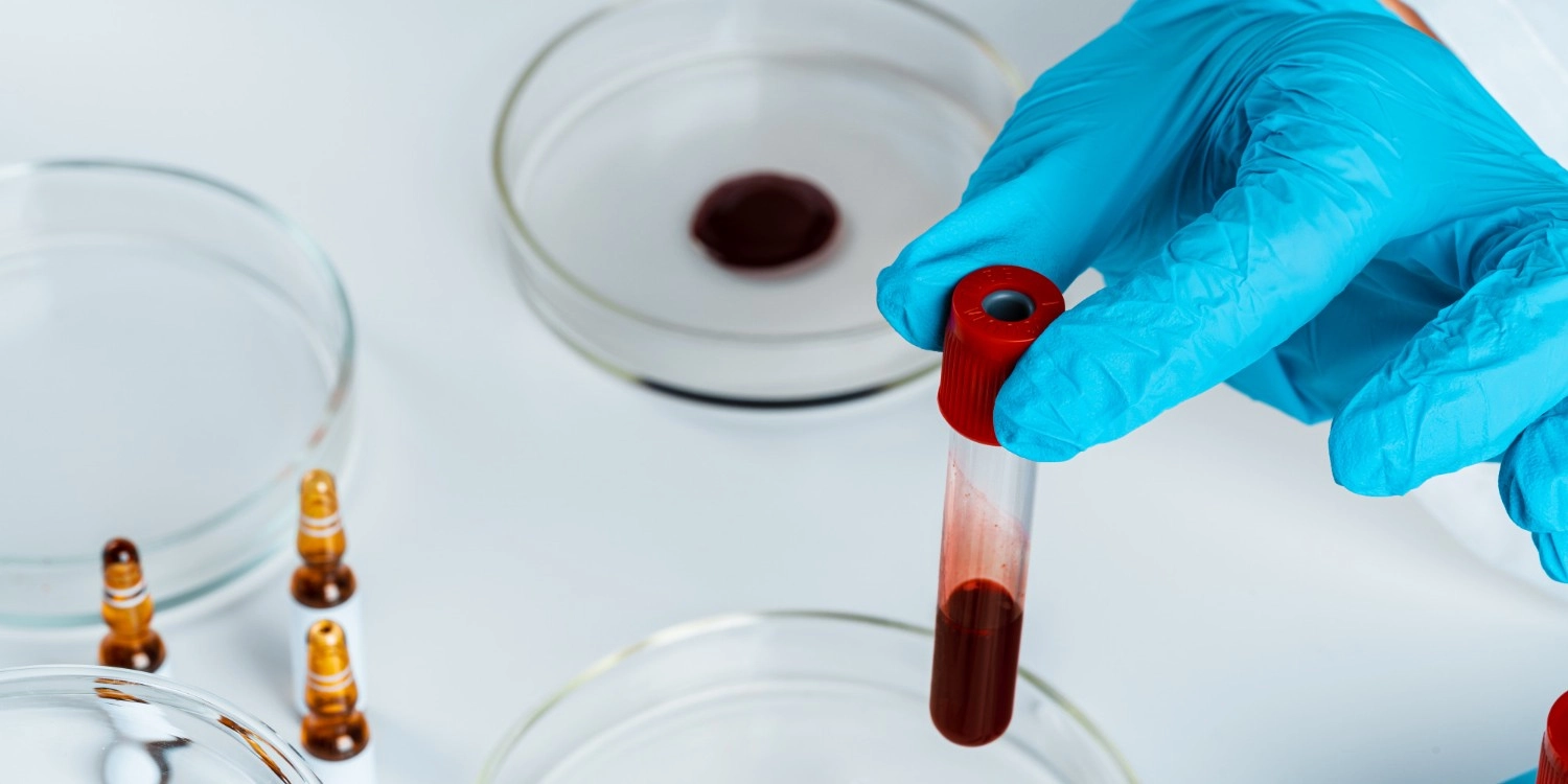 Laboratorio Perez Elizalde - Servicios - Monitoreo de Drogas de Abuso y Terapeuticas (4)