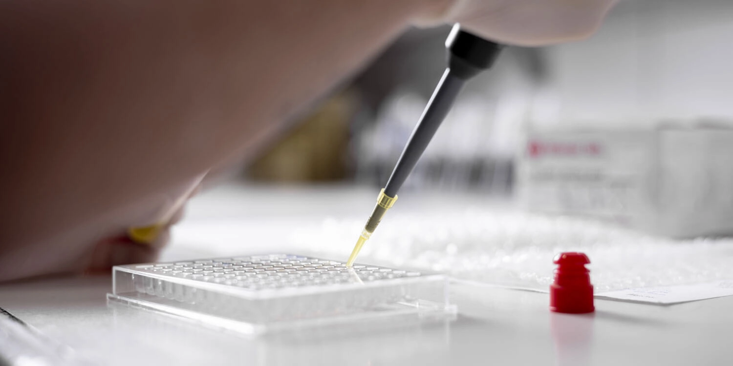 Laboratorio Perez Elizalde - Servicios - Quimica clinica (1)