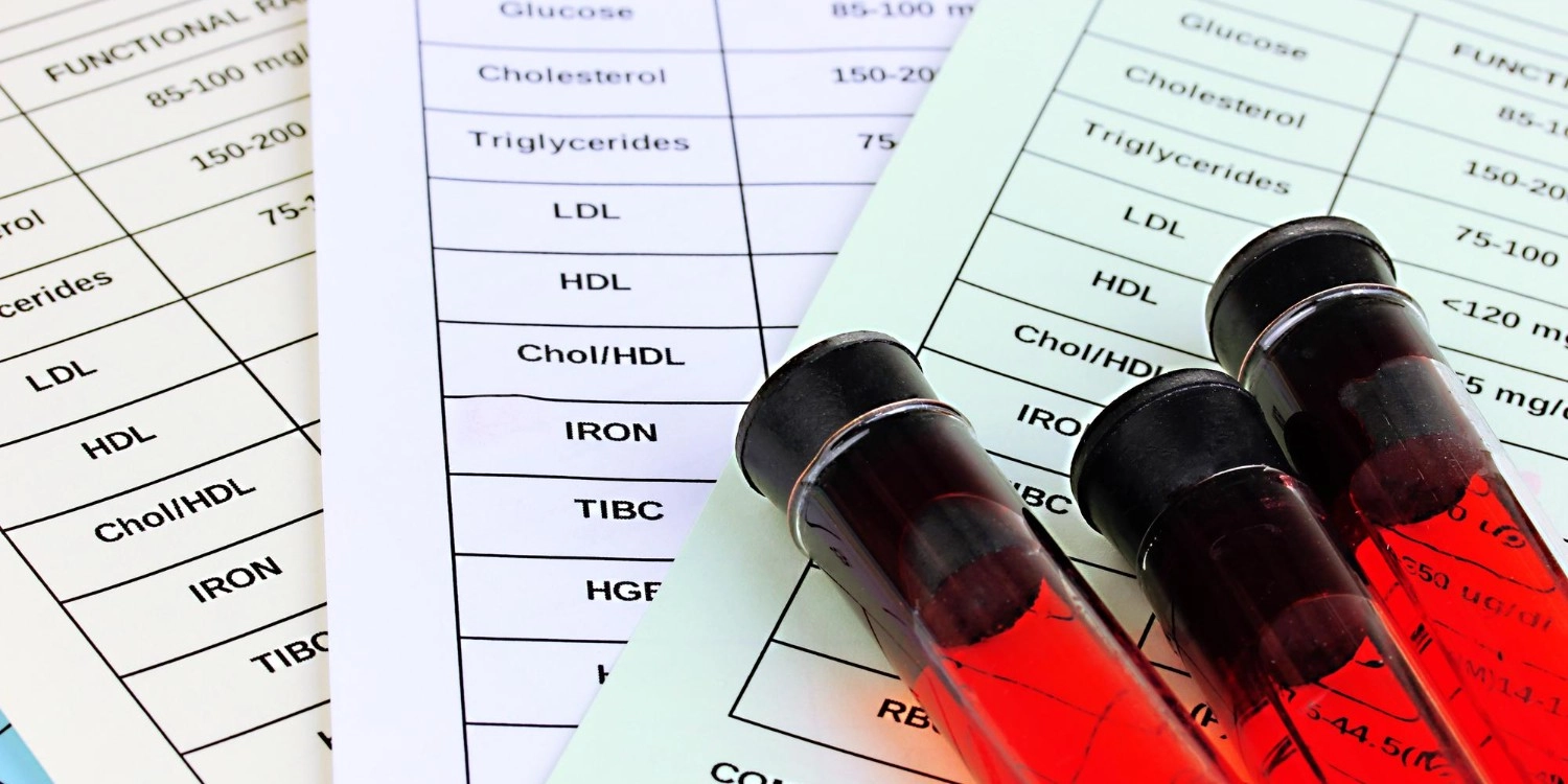Laboratorio Perez Elizalde - Servicios - Toxicología laboral (1)