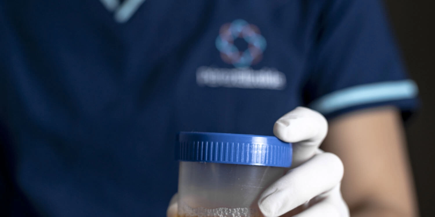 Laboratorio Perez Elizalde - Servicios - Uroanalisis (2)