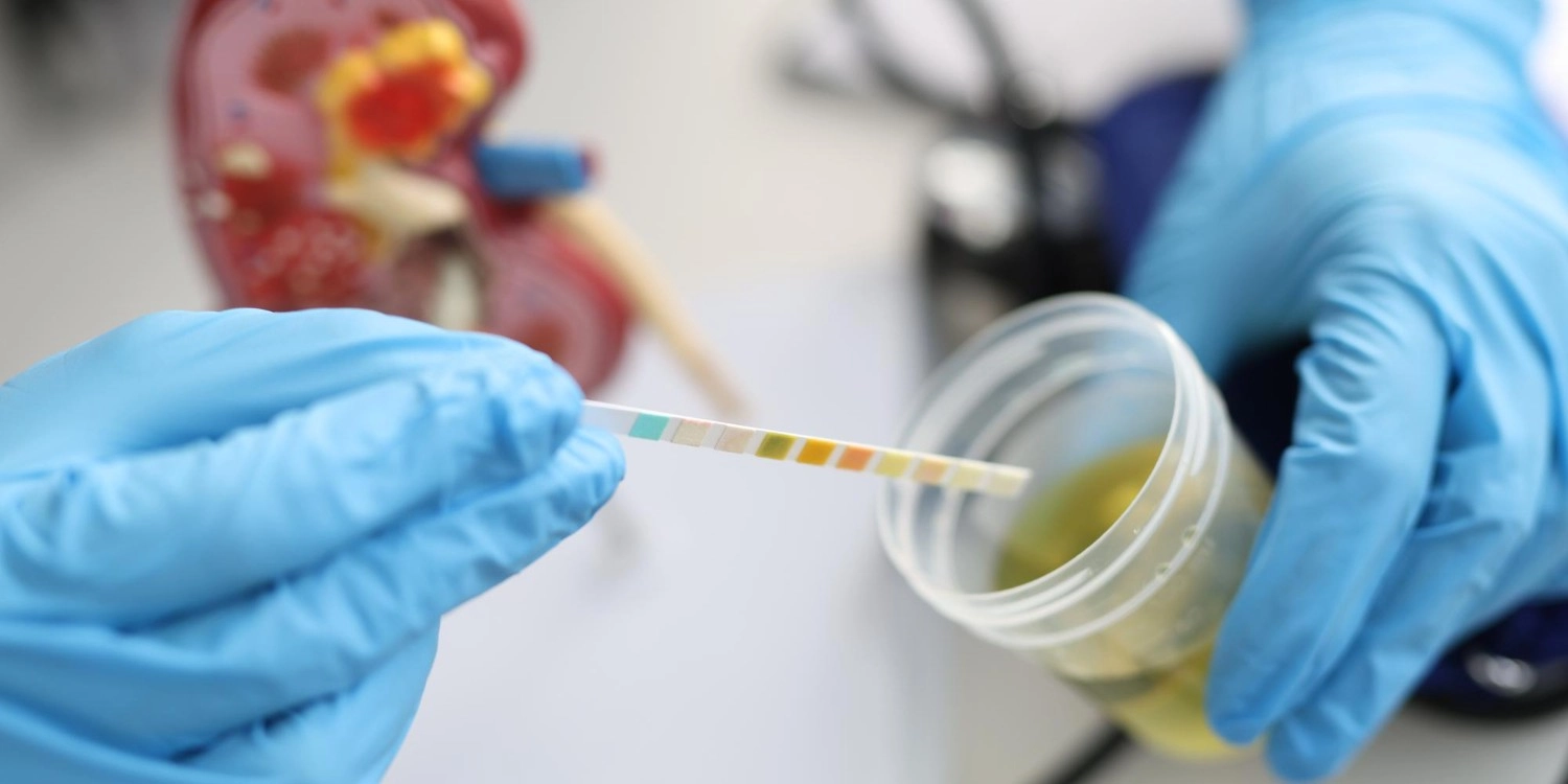 Laboratorio Perez Elizalde - Servicios - Uroanalisis (3)