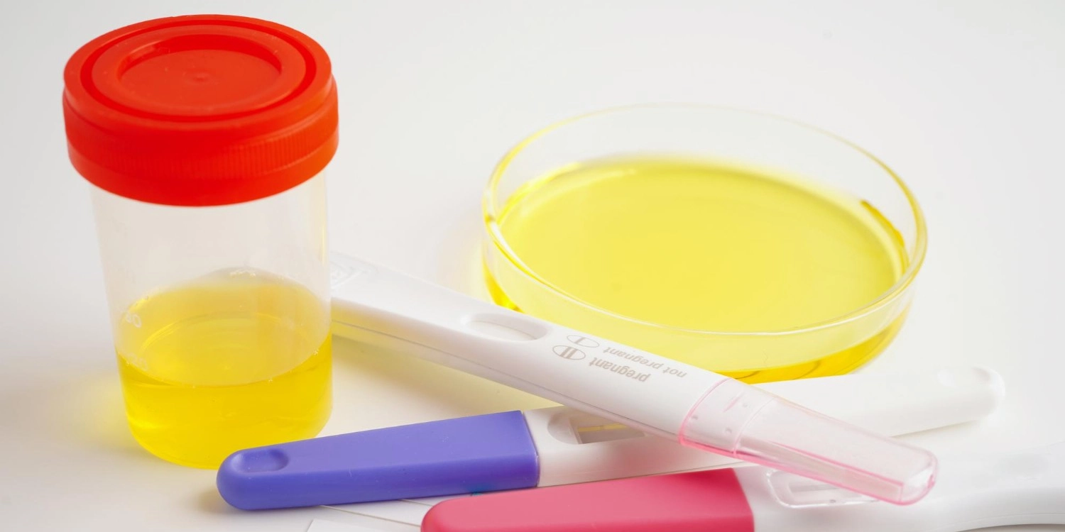 Laboratorio Perez Elizalde - Servicios - Uroanalisis (4)