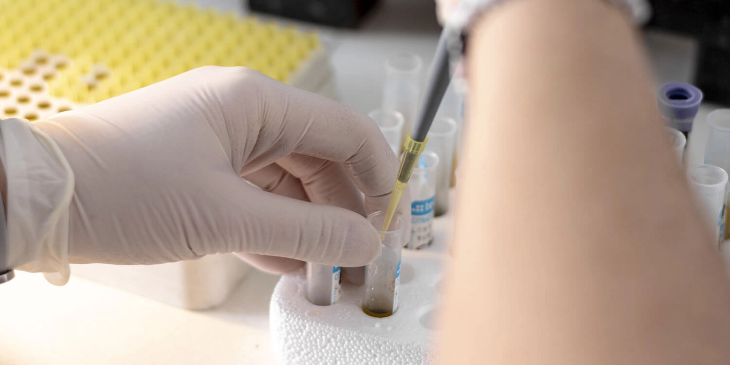 Laboratorio Perez Elizalde - Servicios - Virologia (1)